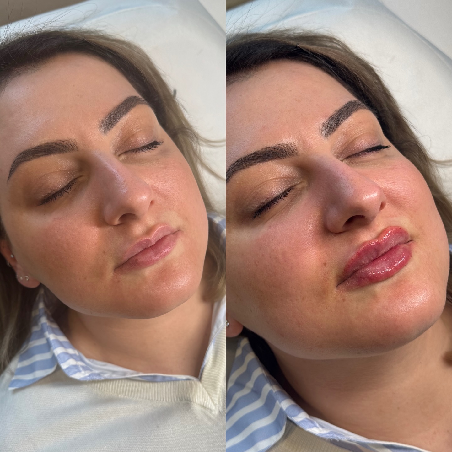Instagram: Gesicht Makeover Vorher Nachher bei Suna Kaya Beauty