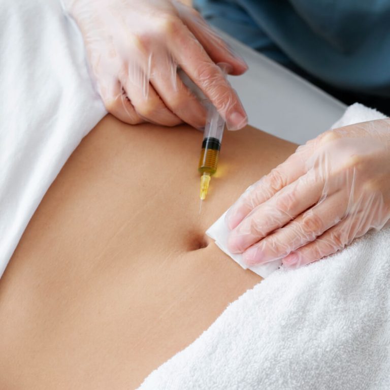 Fett-weg-Spritze Bauch Injektion Fettreduktion Beauty by Suna Kaya Neu-Isenburg