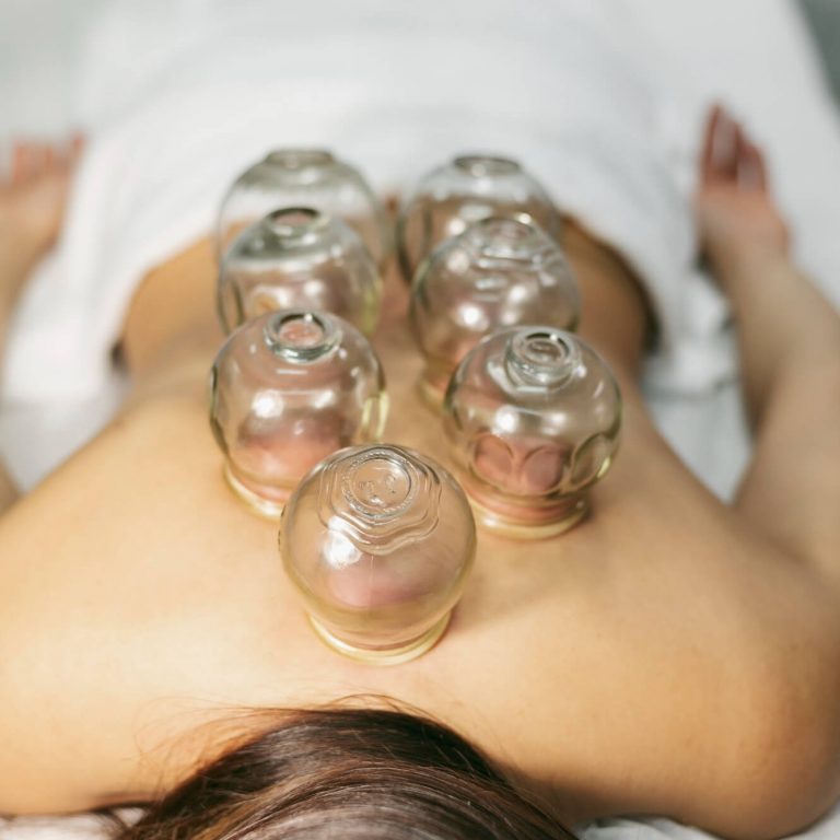 Hijama Schröpftherapie Behandlung Beauty by Suna Kaya Neu-Isenburg