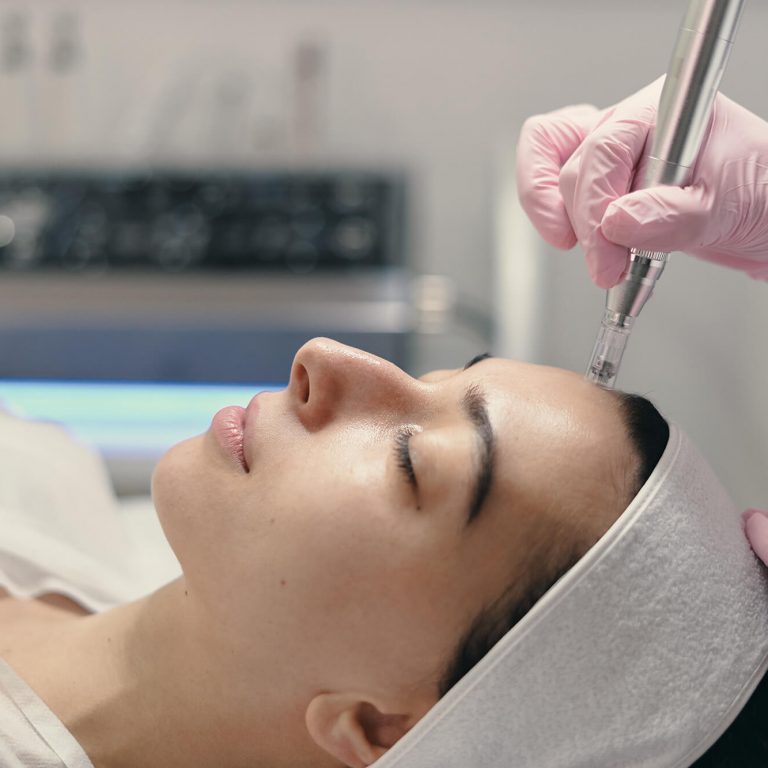 Microneedling Preise - Suna Kaya